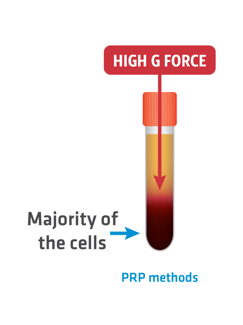 vs-high-gforce